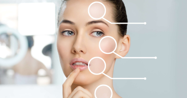 التصبغات والاثر